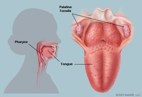 Picture of Tonsils
