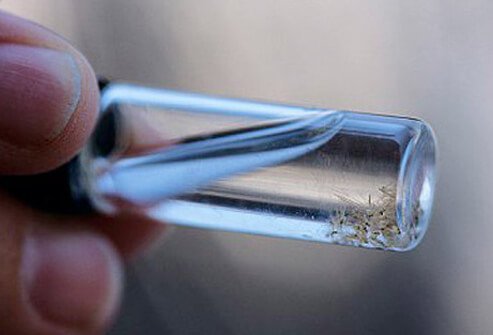 Sleeping on the beach may sound romantic … until you think about sand flies.