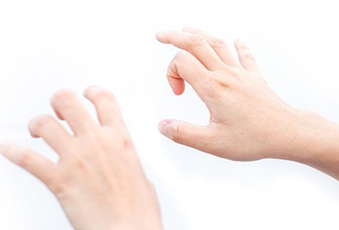Trigger finger can cause any digits of the hand to lock when opening or closing.