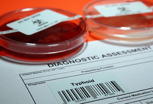 Typhoid fever is typically caused by a bacteria called Salmonella typhi, which only infects and sickens humans. Typhoid fever is typically caused by a bacteria called Salmonella typhi, which only infects and sickens humans.