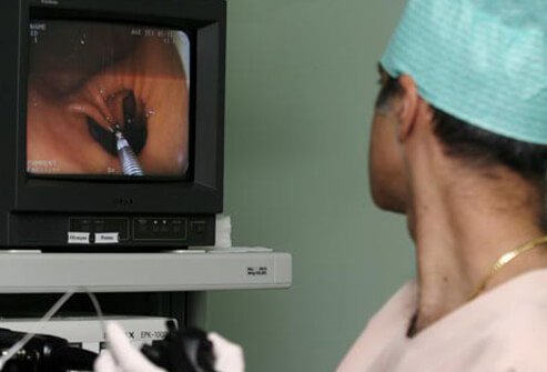 Colonoscopy also allows biopsies to be taken of the colonic lining to confirm the diagnosis.