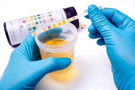 Picture of urine dipstick and color box instructions