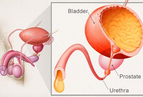 Searching for the nature and cause of your incontinence is important to finding treatments that can help.