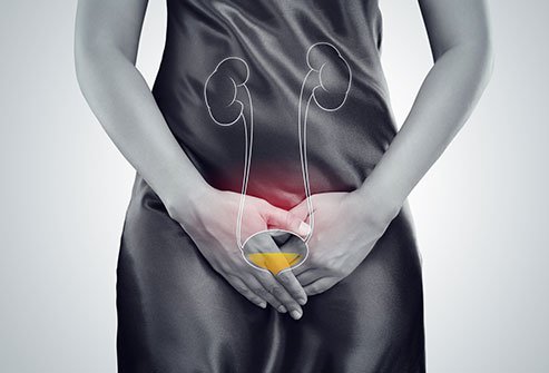 Image of a woman retaining urine.