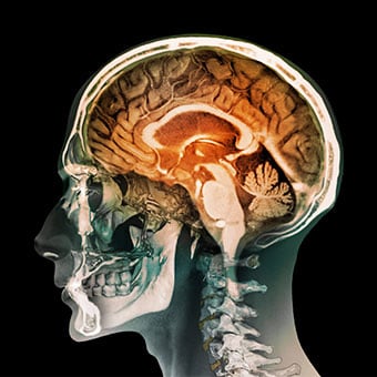 A MRI of the brain and spinal cord.