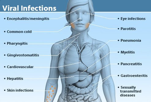 A viral infection is a proliferation of a harmful virus inside your body.