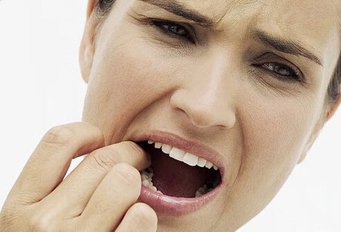 Manifestations of IBD may occur outside the digestive tract.