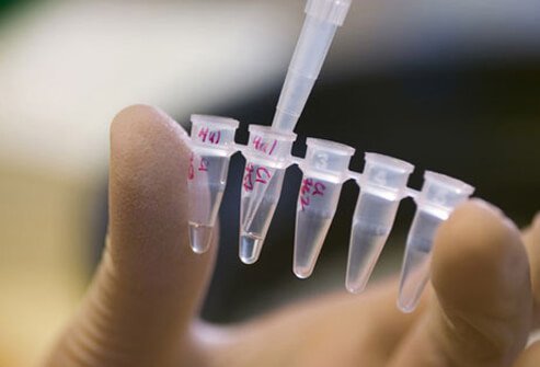 What is known is that a combination of genetic and environmental factors results in ongoing inflammation localized mostly to the bowel that for some reason is not controlled.