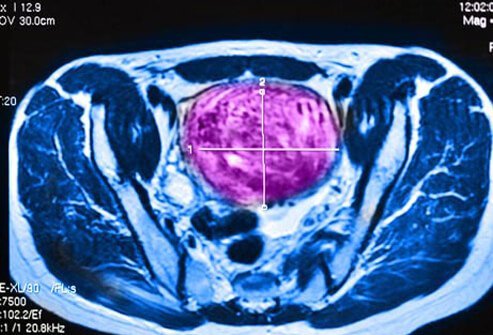 MRI-guided ultrasound can sometimes be provided inside your doctor's office.