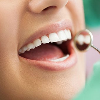 A female patient has her teeth examined by a dentist.