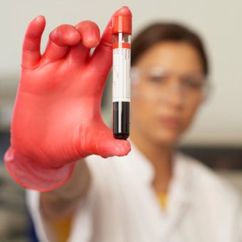 A lab technician holds a blood test tube.