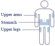 Clean the injection site with an alcohol swab or soap and water - Illustration Clean the injection site with an alcohol swab or soap and water - Illustration