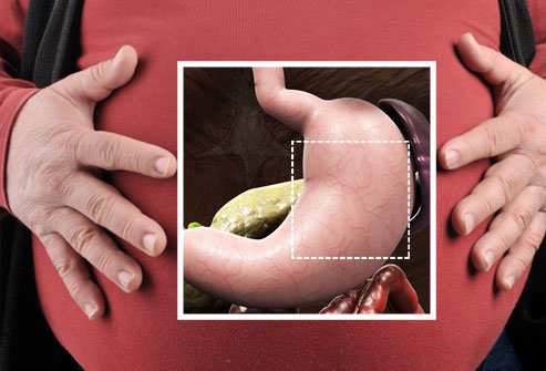 There is more than one way to lose weight through surgery.