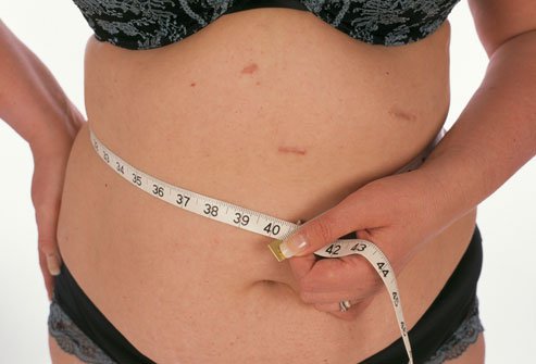Weight loss results vary by surgery, but may be as much as one pound per day.