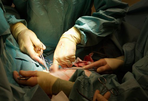 Weight loss surgery comes with some risks, like all surgery, but serious problems are rare.