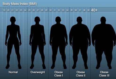 To qualify for weight loss surgery, you have to be more than 100 lbs. overweight or have certain medical conditions.