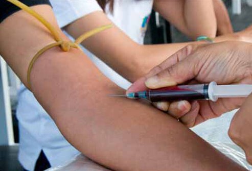 The diagnosis of West Nile virus infection is confirmed with a blood or cerebrospinal fluid test.