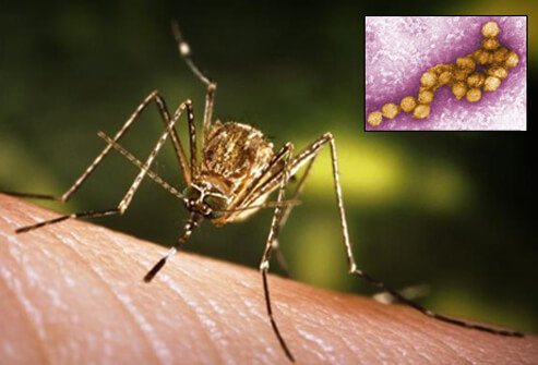 Most humans who contract the virus have been bitten by an infected mosquito.