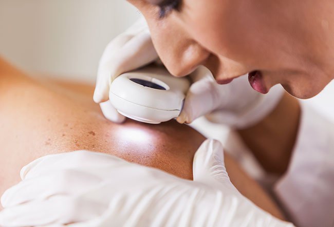 A skin lesion is an abnormal growth or rash. 