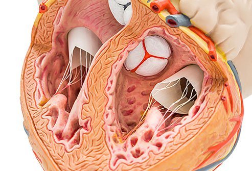 Transcatheter aortic valve replacement (TAVR) is a surgical procedure to artificially replace a narrowed aortic valve due to aortic valve stenosis.