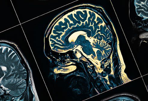 There are several different kinds of schizophrenia each with slightly differing symptoms. There are several different kinds of schizophrenia each with slightly differing symptoms.