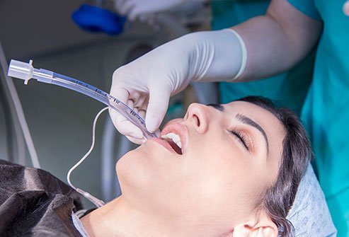 Nasotracheal Intubation Nasotracheal Intubation