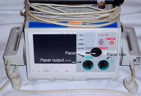 Transcutaneous cardiac pacing (TCP) temporarily paces a patient's heart during an emergency and stabilizes them. Transcutaneous cardiac pacing (TCP) temporarily paces a patient's heart during an emergency and stabilizes them.