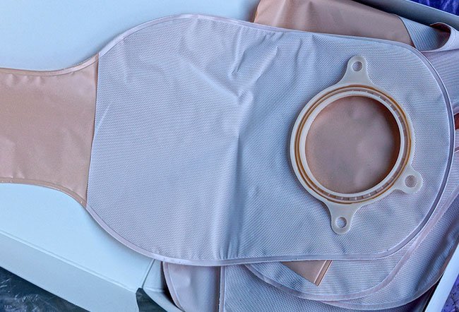 A colostomy is a surgery where an opening is made from the colon out through the abdomen allowing stools to pass out through the abdomen instead of passing through the bowels and rectum.