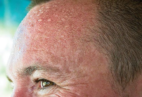 This is what is behind menopausal hot flashes.