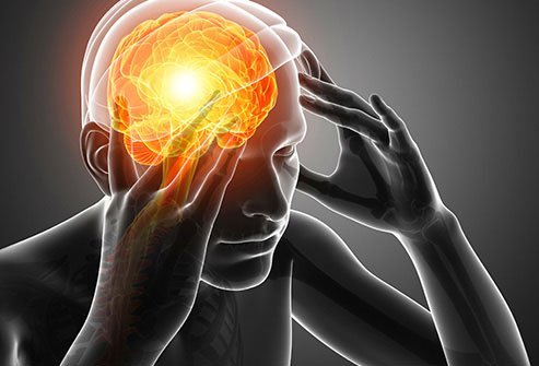 These painful and sometimes disabling headaches can also mess with your autonomic nervous system.
