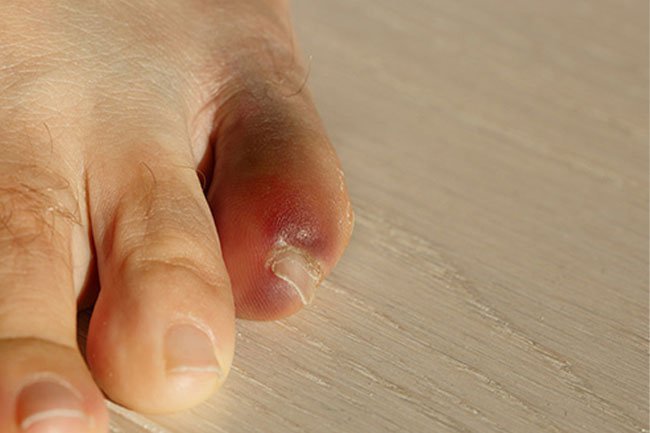 Breaking a bone usually feels like an intense deep ache. 