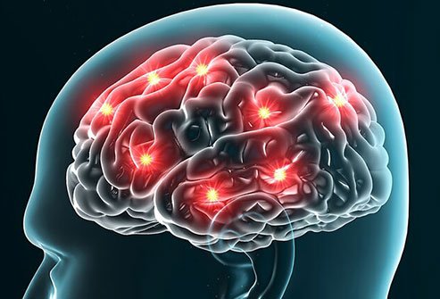 Caffeine can be addictive and change brain chemistry. 