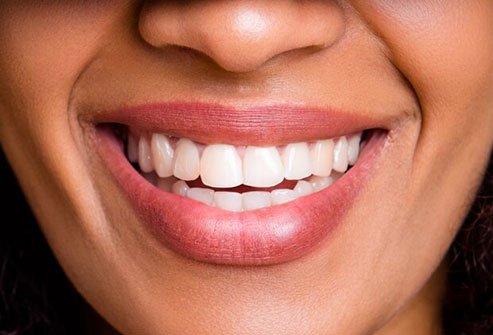 Caffeinated drinks often stain your teeth and dry out your mouth. 