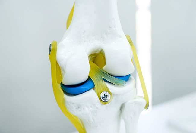 Ligaments are tough bands of tissue around your joints. Ligaments connect bone to bone, support the joints and perform other functions. 