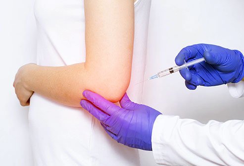In a medial epicondyle injection, medications are injected into the elbow joint to treat diseases of the joint, such as arthritis.