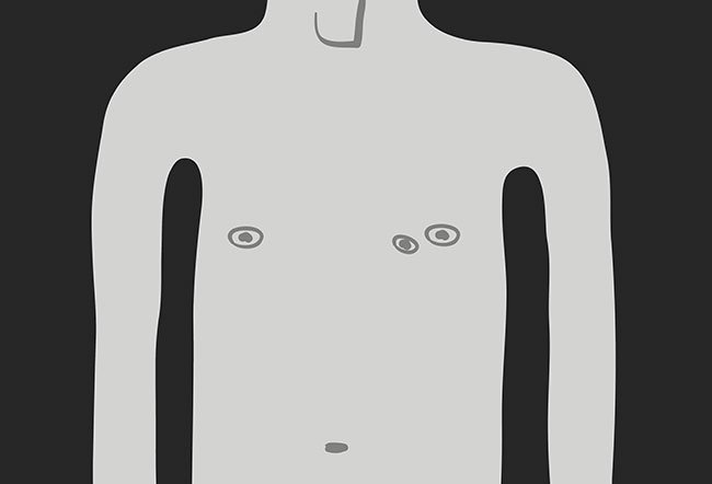third nipple