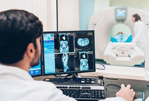 MRI scan