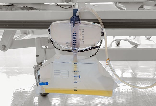 Oliguria and anuria are signs that kidney function is declining or not up to the mark.