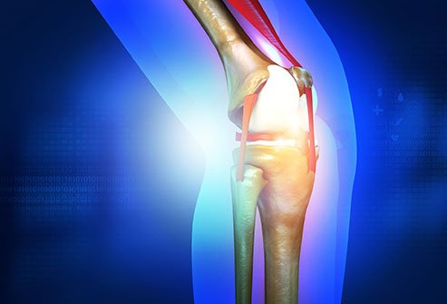 Osteochondral grafting treats conditions in which there is cartilage damage and the underlying bone is exposed. 