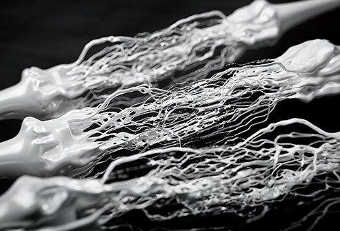 Amyotrophic lateral sclerosis (ALS) is the disease of motor neurons. 