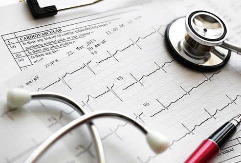 Damaged heart muscle, blocked or narrowed blood vessels (coronary heart disease), and other kinds of ticker trouble can stop enough blood loaded with oxygen from getting to your brain.