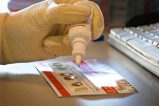 At-home tests do not require preparation, but they may give false-positive results. 