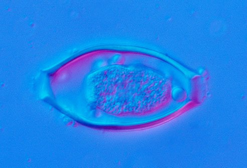 Parasites do a whole lot of bad, but some researchers are trying to find out if they might be used for good, too.