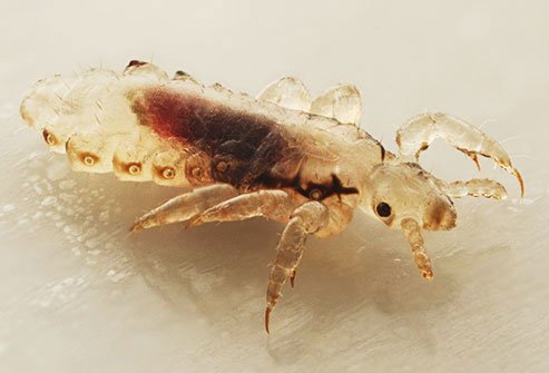 Only body lice spread diseases.