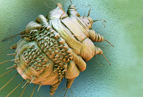 A mite that digs into your body and lays eggs causes this condition.