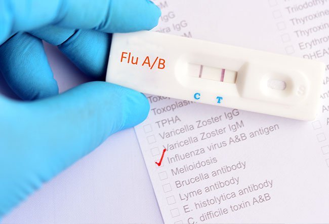 Flu or influenza is a contagious (spreads from person to person) viral illness that affects the respiratory tract (the nose, throat and lungs). Type A influenza is generally considered worse than type B influenza.