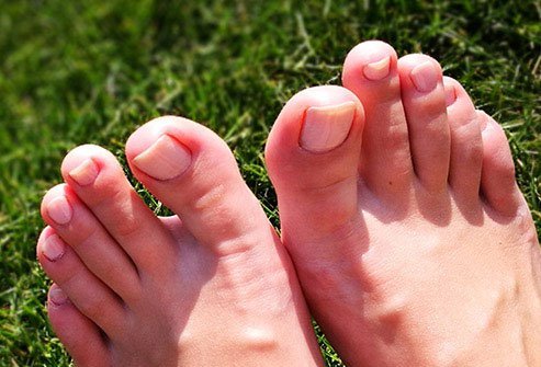 Whether you're washing your hands or admiring a manicure, you spend a lot more time looking at your fingernails than your toenails.