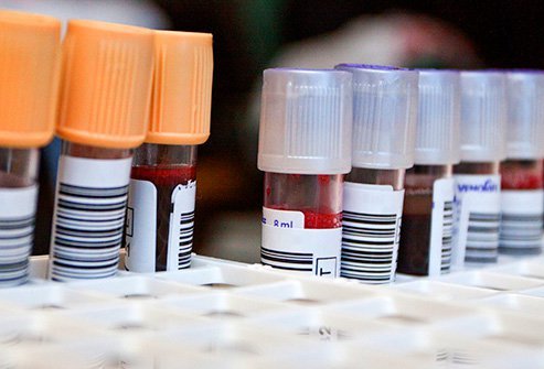 High cholesterol and kidney disease are some of the problems blood tests can recognize.