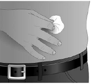 Prepare the infusion site  - Illustration