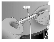 Make sure the needle is not in a blood vessel - Illustration